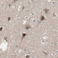 HPA IHC Cerebral cortex — SNX4