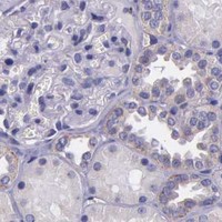 HPA IHC Kidney — NSDHL