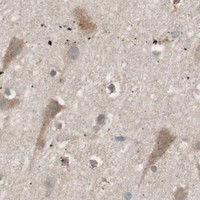 HPA IHC Cerebral cortex — SDC4