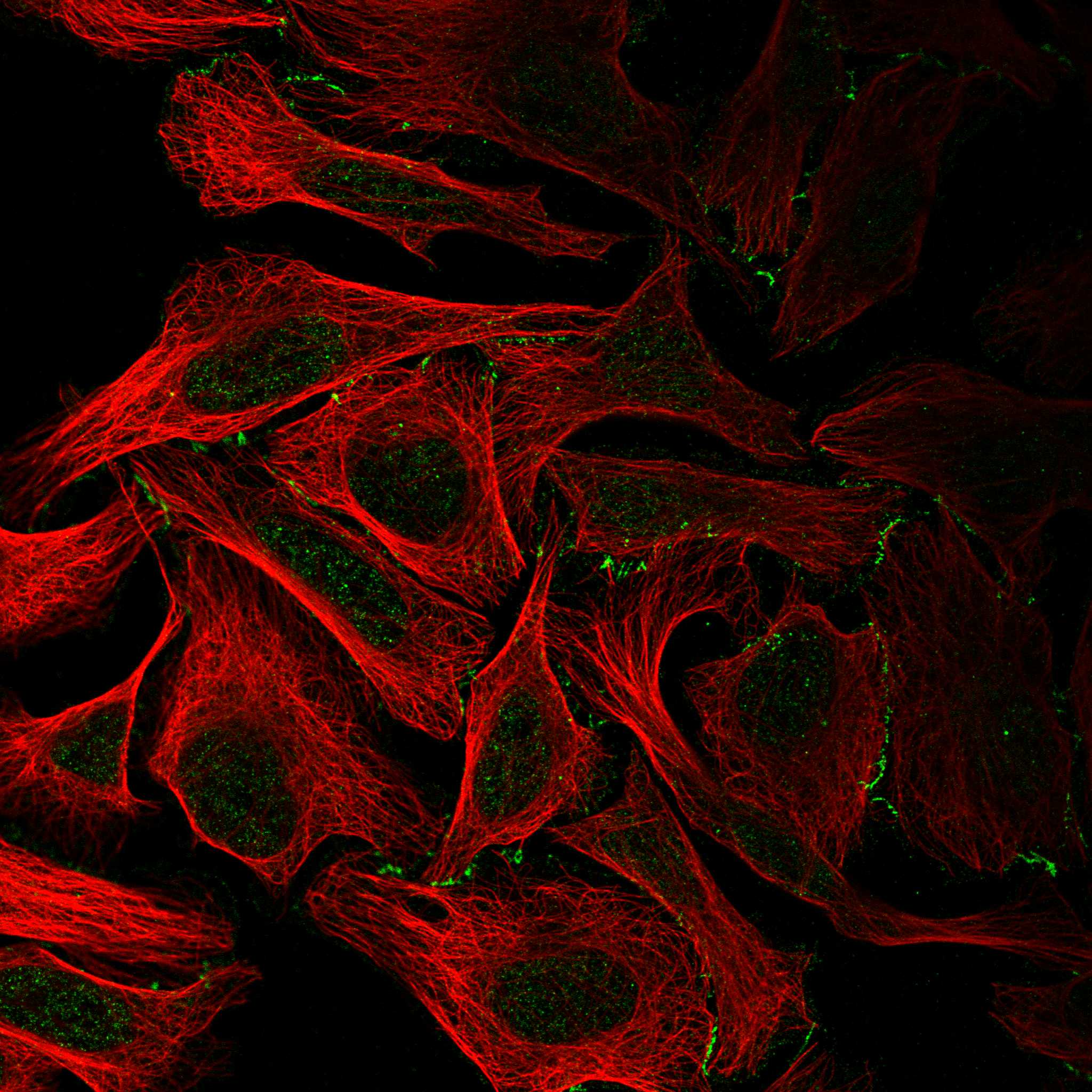 Subcellular DDR1 The Human Protein Atlas