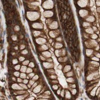 HPA IHC Colon — VASP