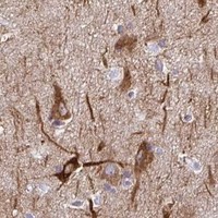 HPA IHC Cerebral cortex — AK5