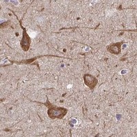 HPA IHC Caudate — AK5