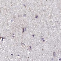 HPA IHC Cerebral cortex — XAF1