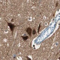 HPA IHC Cerebral cortex — CNOT4