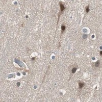 HPA IHC Cerebral cortex — PIK3R3