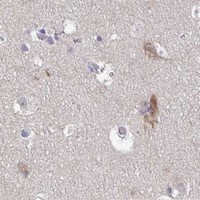 HPA IHC Cerebral cortex — CD1E