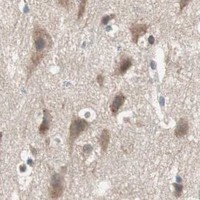 HPA IHC Cerebral cortex — GART