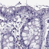 HPA IHC Colon — GNG7