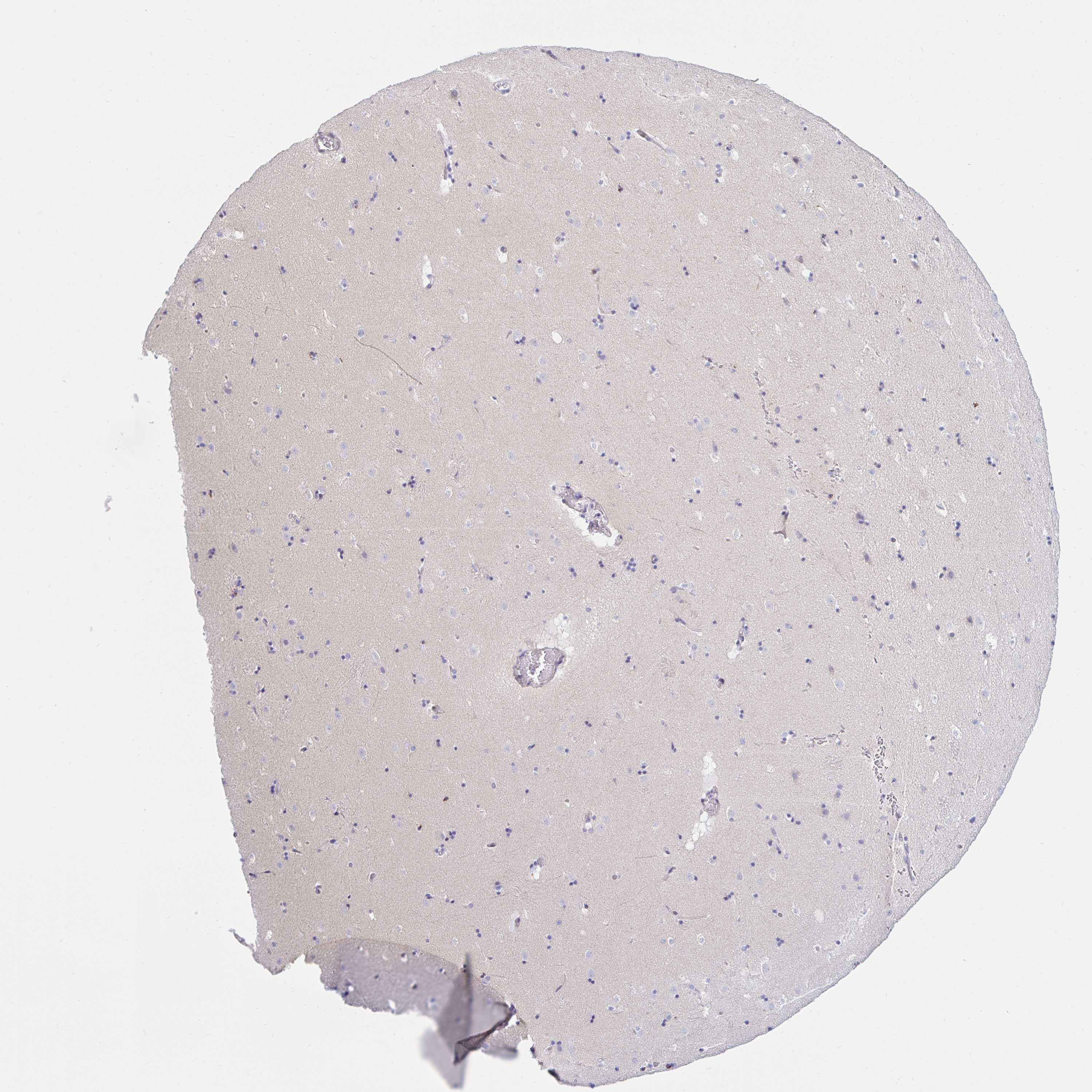 (194)直筆サイン入りELAST iDENTIFICATION NATURE Tissue expression of NBPF3 - Staining in caudate - The Human