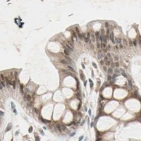 HPA IHC Colon — PRDM2