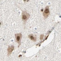 HPA IHC Cerebral cortex — PRDM2