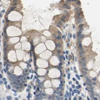 HPA IHC Colon — RASD2