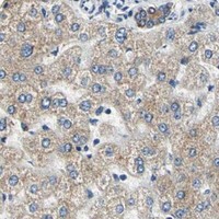 HPA IHC Liver — RASD2
