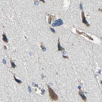 HPA IHC Cerebral cortex — RASD2