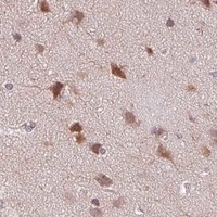 HPA IHC Cerebral cortex — DNAJB6