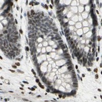 HPA IHC Colon — KDM1A