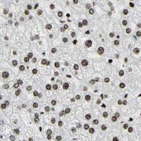 HPA IHC Liver — KDM1A
