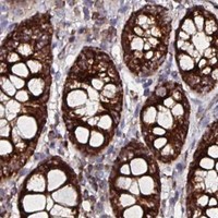 HPA IHC Colon — ATAD3A