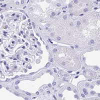 HPA IHC Kidney — RUNX3