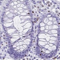 HPA IHC Colon — RUNX3