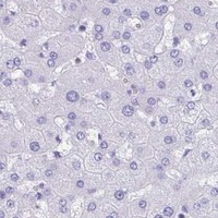 HPA IHC Liver — RUNX3