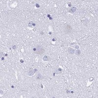 HPA IHC Cerebral cortex — RUNX3