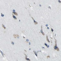 HPA IHC Cerebral cortex — TRIM25