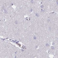 HPA IHC Cerebral cortex — IKZF2