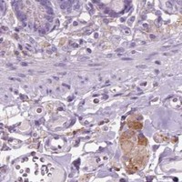 HPA IHC Small intestine — DNM1