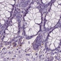HPA IHC Colon — DNM1