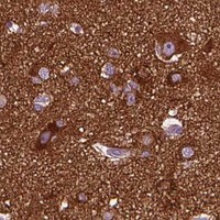 HPA IHC Cerebral cortex — DNM1