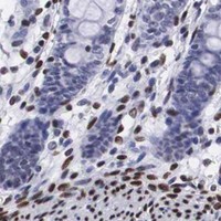 HPA IHC Colon — MECP2