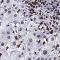 HPA IHC Liver — MECP2
