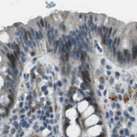 HPA IHC Colon — PJA1