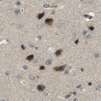 HPA IHC Cerebral cortex — PJA1
