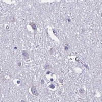 HPA IHC Cerebral cortex — CARD9