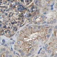 HPA IHC Kidney — PARVA