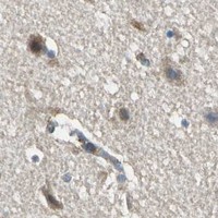 HPA IHC Cerebral cortex — PARVA