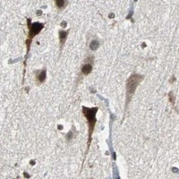 HPA IHC Cerebral cortex — HLX
