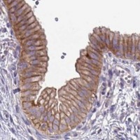 HPA IHC Gallbladder — STK26