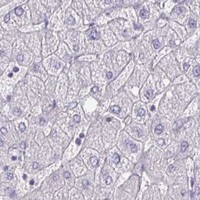 HPA IHC Liver — STK26
