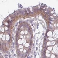 HPA IHC Colon — STK26