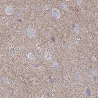 HPA IHC Cerebral cortex — STK26