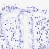 HPA IHC Colon — CALD1