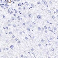 HPA IHC Liver — CALD1