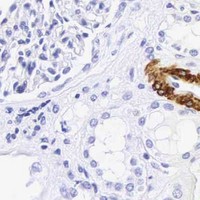 HPA IHC Kidney — CALD1