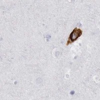 HPA IHC Cerebral cortex — CALD1