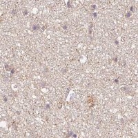 HPA IHC Cerebral cortex — RAB11A
