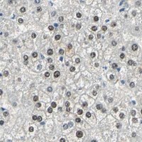 HPA IHC Liver — NFIA